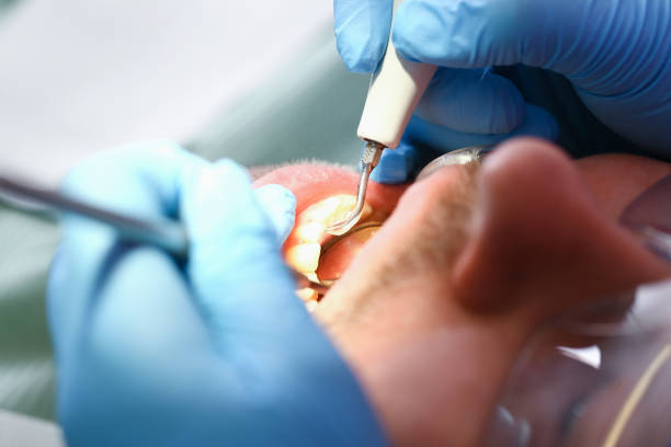 Best Pediatric Emergency Dentist in Rugby, ND