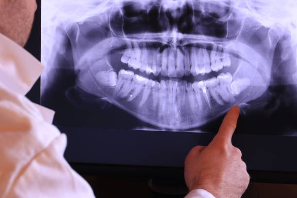 Best Emergency Broken Tooth Repair in Rugby, ND