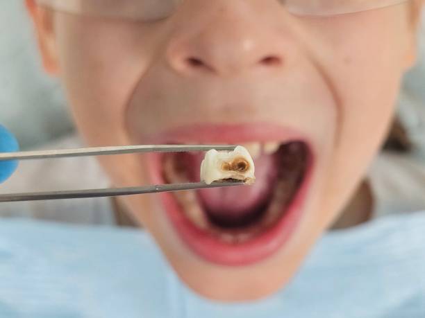 Best Emergency Treatment for Toothache in Rugby, ND